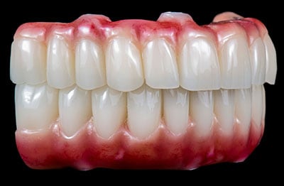 picture of dentures