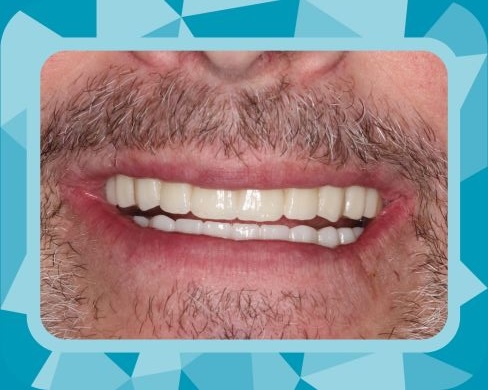 Rise Dental Surgery & Implant Center patient results