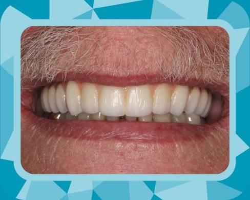 Rise Dental Surgery & Implant Center patient results