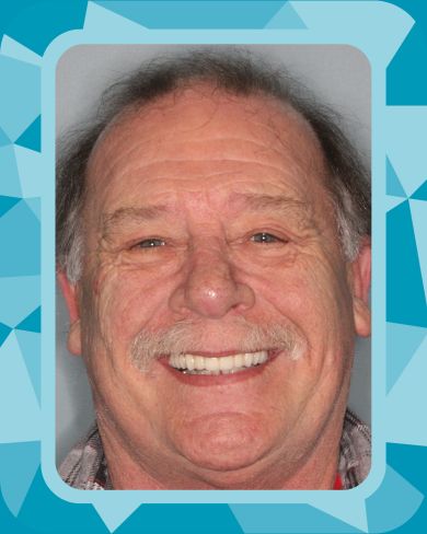 Rise Dental Surgery & Implant Center patient results