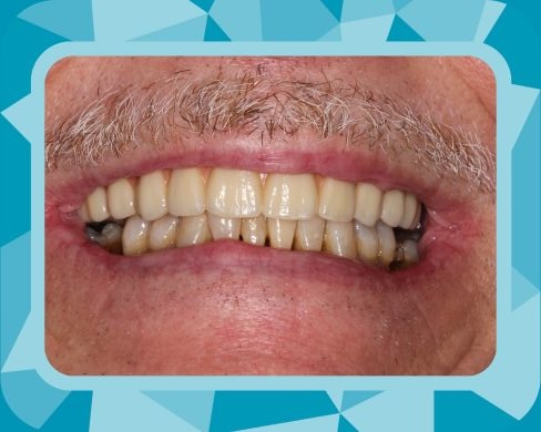 Rise Dental Surgery & Implant Center patient results