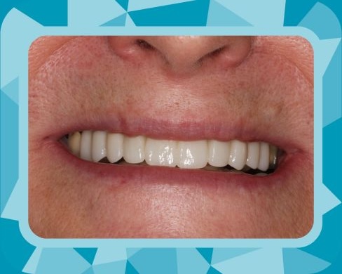 Rise Dental Surgery & Implant Center patient results