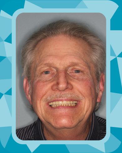 Rise Dental Surgery & Implant Center patient results
